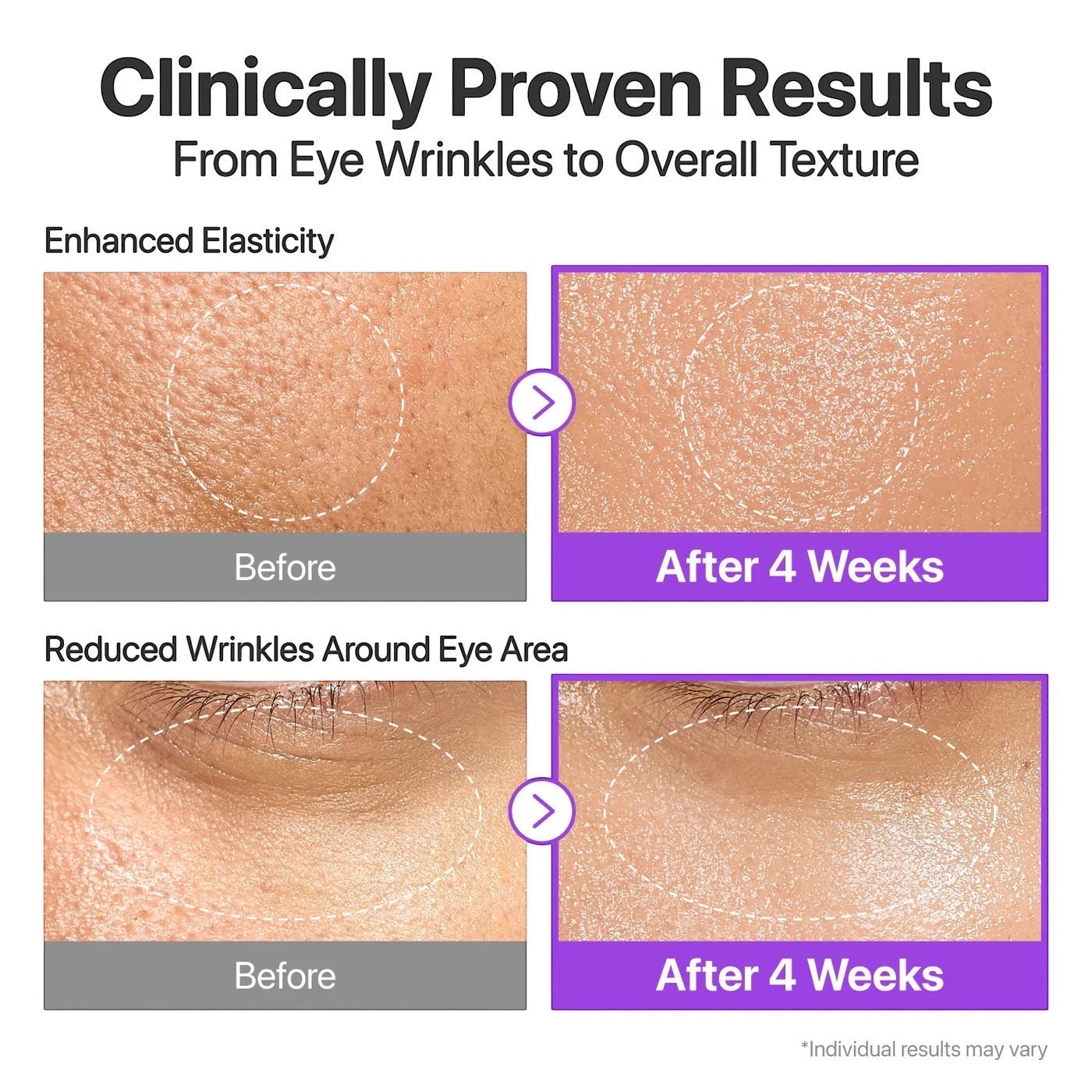 bareskin.lt clinical before and after results of numbuzin No.9 NAD Bio Lifting Essence showing improved skin texture.
