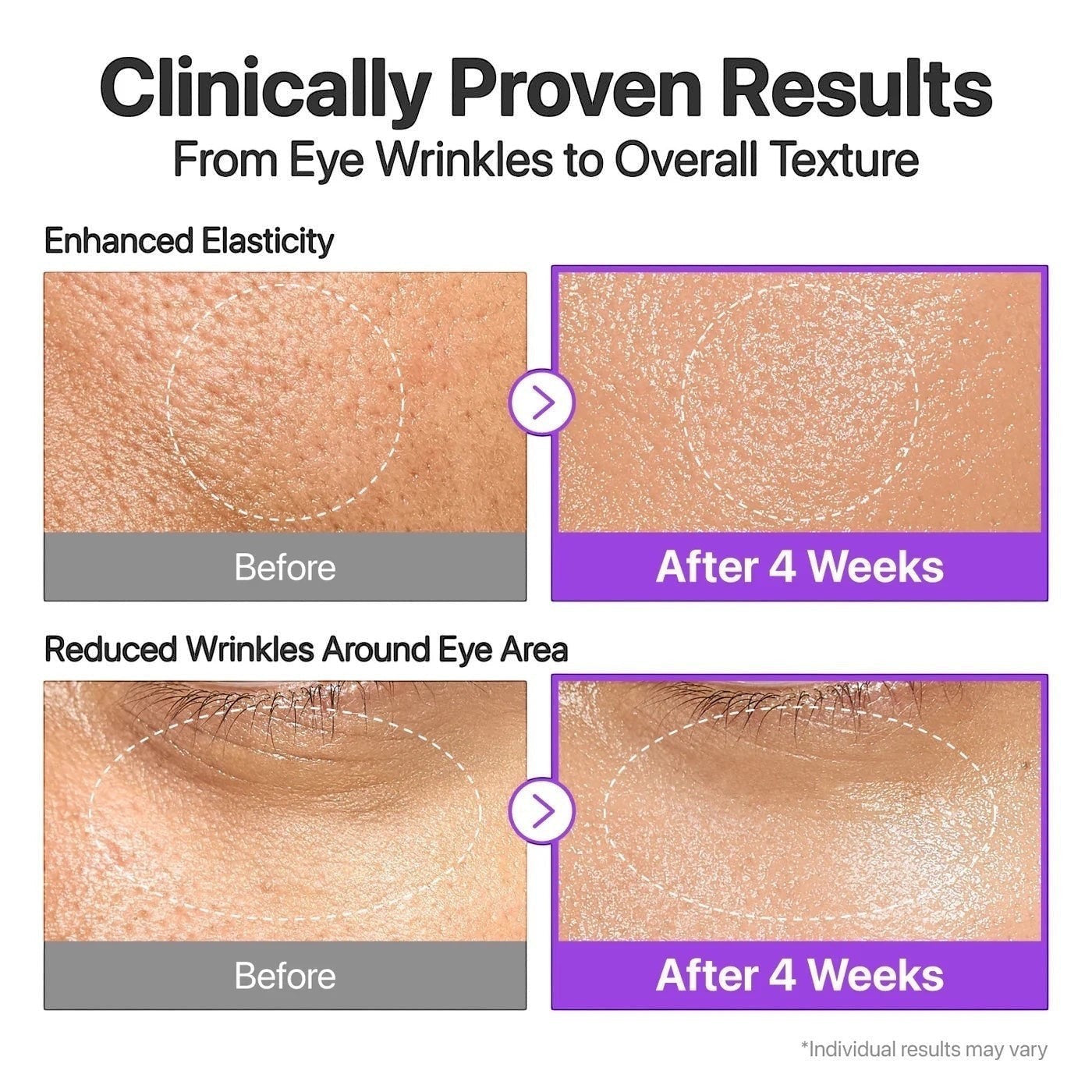 bareskin.lt clinical before and after results of numbuzin No.9 NAD Bio Lifting Essence showing improved skin texture.