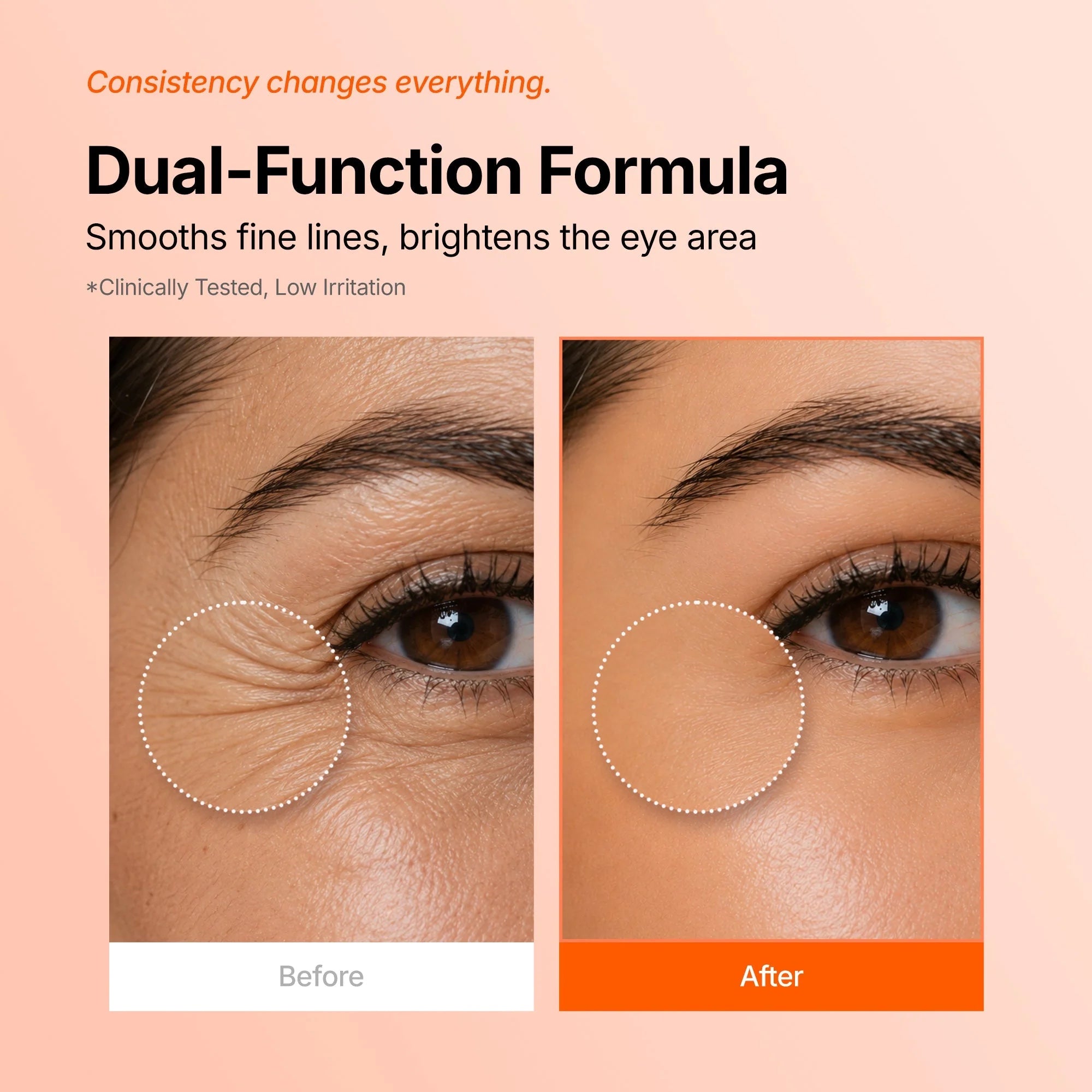 Genabelle - PDRN 360 Rejuvenating Eye Mask - paakių padeliai